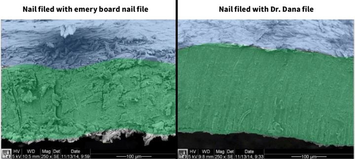 Dr. Dana Stern on Emery Boards and Nail Damage