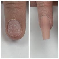 Before and After