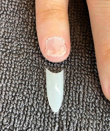 How to Correct Ski Jump Nails