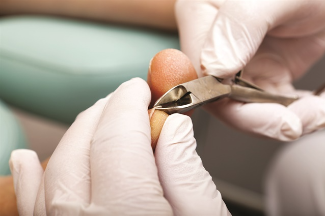 A doctor can prevent ingrown toenails from reoccurring.