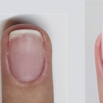 Bio Sculpture Gel Supreme French With Extended Nail Bed