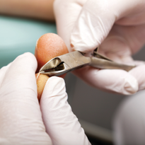 The Industry’s Issue With Ingrown Nails